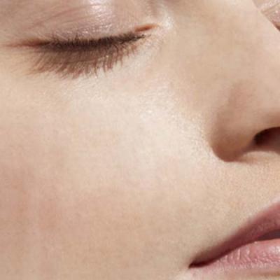 Peaux intolérantes au soleil : nos solutions