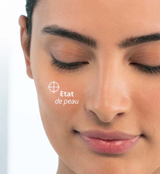 etat de peau